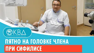 😐 Пятно на головке члена при сифилисе. Клинический случай №363