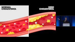Холестерин Полезен или Вреден? Обзор Исследований | Доктор Нил Барнард
