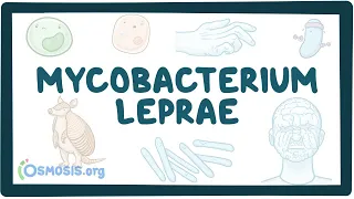 Mycobacterium leprae - an Osmosis Preview