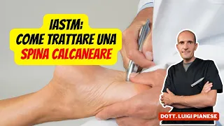 Spina calcaneare: il Trattamento efficace con uno IASTM Professionale!