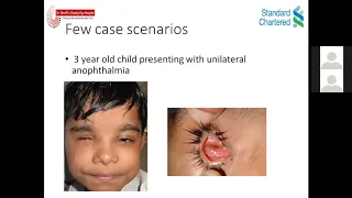 Pediatric Oculoplasty disorders