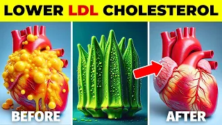 TOP 10 Foods To LOWER Bad (LDL) Cholesterol Naturally