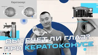 Кератоконус - Его нельзя вылечить, но можно замедлить.