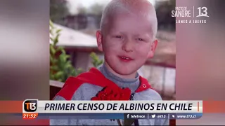 Primer censo de albinos en Chile