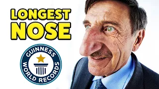 Life with the longest nose - Guinness World Records