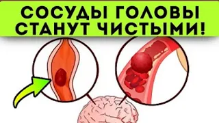 Смотрите, что делают старые врачи для чистки сосудов головы! Сосуд...