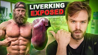 Vegan Reacts To Liver-King [STEROIDS] - Liver King Exposed