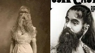 Famous Bearded Women in History