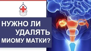 🔵 Что такое миома матки, и как ее лечить. Как лечить миому матки. 12+