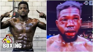Worst boxing injuries: Erickson Lubin’s face was unrecognisable after severe punishment - Boxin...