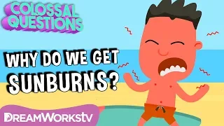 Why Do You Get Sunburns? | COLOSSAL QUESTIONS