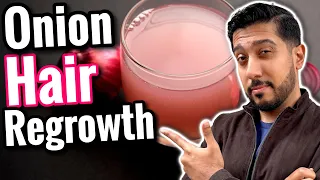 Onion Juice for Hair Growth | REGROW Hair With Onion Juice