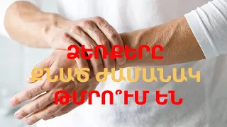 Ձեռքերը քնած ժամանակ թմրո՞ւմ են