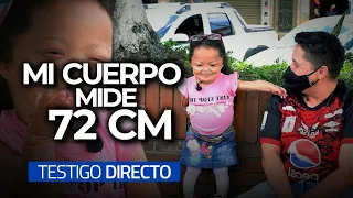 LA MUJER MÁS PEQUEÑA: Cuerpo diminuto y corazón valiente - Testigo Directo