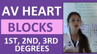 How to Interpret AV Heart Blocks Ekg Heart Rhythms | 1st degree, 2nd degree, 3rd degree difference