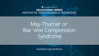 Episode 6 | May-Thurner or Iliac Vein Compression Syndrome