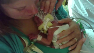 Premature Babies | One Born Every Minute