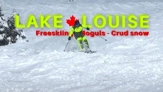 Skiing Movie | Moguls - Crud snow | LAKE LOUISE | ROSSIGNOL EXPERIENCE 86 Ti | Jimmy Crawford