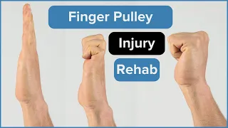 How To Rehab a Climbing Pulley Injury