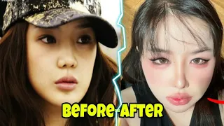 PARK BOM 2NE1 BEFORE-AFTER PLASTIC SURGERY ♥️✨