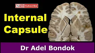 Internal Capsule, Dr Adel Bondok