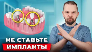 Вот кому нельзя ставить импланты! Правда о которой молчат стоматологи...