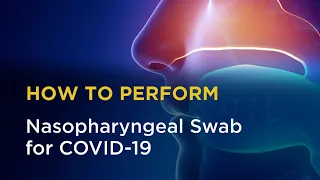 Nasopharyngeal Swab for COVID-19