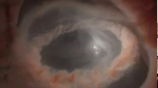 Artistic animation of the stellar movements in GW Orionis