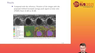 IUS-2021: Pixel-wise deep reinforcement approach for ultrasound image denoising