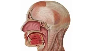 Finding and Removing Tongue Cancer