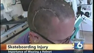Skate Board Brain Injuries