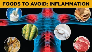 9 Foods that Cause Inflammation (Science-Based)