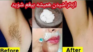 بهترین و آسانترین  روش از بین بردن موهای زاید برای همیشه