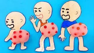 [💸Paperdiy💸] POP THE PIMPLES 👶 Baby family health care tips | Paper Stories