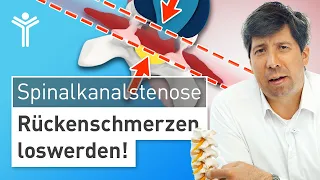 Rückenschmerzen durch Spinalkanalstenose richtig behandeln | Wann operieren?