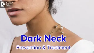 DARK NECK – Causes & Treatment at  Skin Clinic | Few Home Remedies -Dr. Rasya Dixit| Doctors' Circle