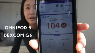 OMNIPOD 5 AND DEXCOM G6 INSULIN PUMP SYSTEM