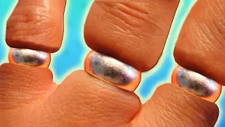 How To Remove A Ring From A Swollen Finger | Life Hack | BEST METHOD