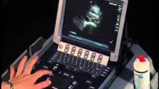 How To: Abdominal Ultrasound - Aorta Measurements