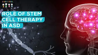 Role of Stem Cell Therapy in Autism Spectrum Disorder