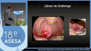 05. 18º CONGRESO ASESA CARTAGENA 2017. Últimas novedades en las vacunas del papilomavirus humano