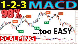 🔴 1-2-3 EMA-MACD "SCALPING" Strategy - One of The Best Absolute Methods for Trading