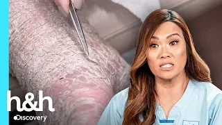 "¡Esto es un misterio para mi!" | Dra. Sandra Lee: Especialista en piel | Discovery H&H