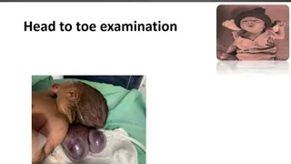 Head to Toe Examination in Newborn I Newborn Examination (Part-3) | Paediatrics