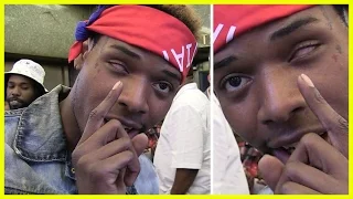 Fetty Wap -- '679' Rapper Explains How He Lost His Left Eye | TMZ