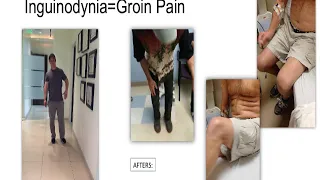Chronic Pain after Inguinal Hernia Repair and How to Prevent It