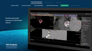 TAVI Analysis - GE Healthcare