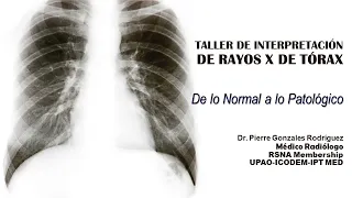 TALLER DE INTERPRETACIÓN DE RAYOS X DE TÓRAX「DE LO NORMAL A LO PATOLÓGICO」