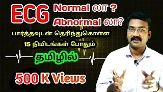 ECG NORMAL OR ABNORMAL FIND IN 15 MIN | ECG IN TAMIL| Learn ECG in tamil | PS TAMIL