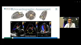 Heart & Vascular Institute Webinar Series - Valvular Heart Disease